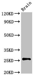 ASCL1 / MASH1 Antibody - Positive Western Blot detected in Rat brain tissue. All lanes: ASCL1 antibody at 3 µg/ml Secondary Goat polyclonal to rabbit IgG at 1/50000 dilution. Predicted band size: 26 KDa. Observed band size: 26 KDa