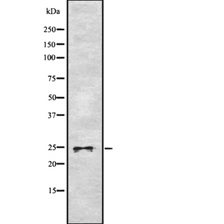 ASCL1 / MASH1 Antibody - Western blot analysis of ASCL1 using RAW264.7 whole cells lysates