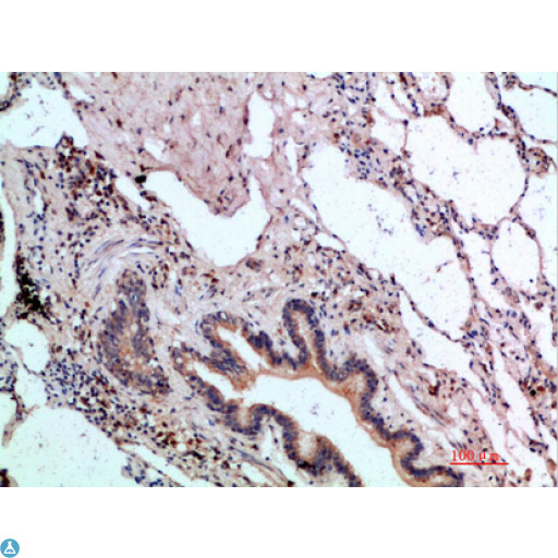 ASCL1 / MASH1 Antibody - Immunohistochemical analysis of paraffin-embedded human-lung, antibody was diluted at 1:200.