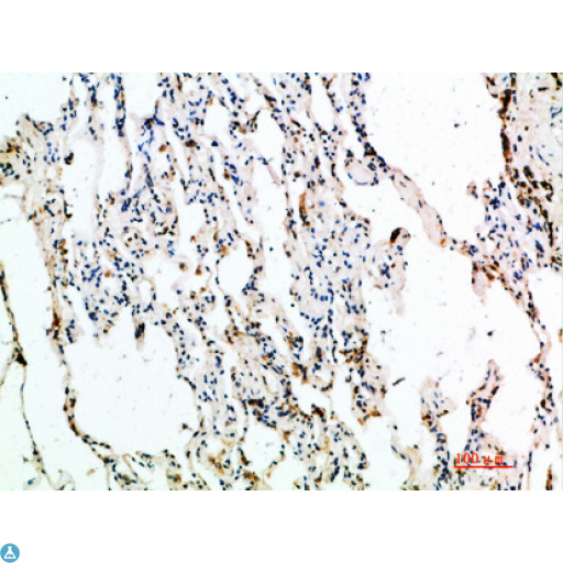 ASCL1 / MASH1 Antibody - Immunohistochemical analysis of paraffin-embedded human-lung, antibody was diluted at 1:200.