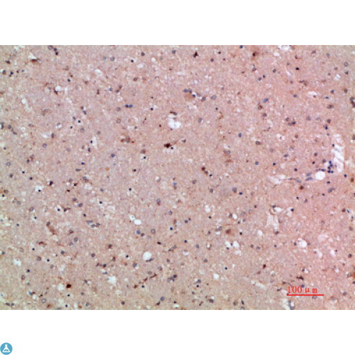ASCL1 / MASH1 Antibody - Immunohistochemical analysis of paraffin-embedded human-brain, antibody was diluted at 1:200.