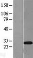ASCL1 / MASH1 Protein - Western validation with an anti-DDK antibody * L: Control HEK293 lysate R: Over-expression lysate