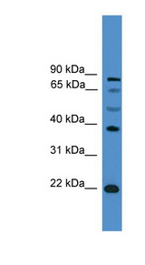 ASCL2 Antibody - ASCL2 antibody Western blot of PANC1 cell lysate. This image was taken for the unconjugated form of this product. Other forms have not been tested.