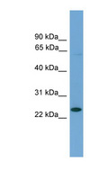 ASCL3 Antibody - ASCL3 antibody Western blot of Mouse Muscle lysate. This image was taken for the unconjugated form of this product. Other forms have not been tested.
