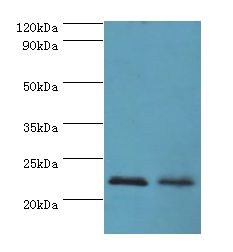 ASF1A Antibody - Western blot. All lanes: ASF1A antibody at 2 ug/ml. Lane 1: Jurkat whole cell lysate. Lane 2: A431 whole cell lysate. Secondary antibody: Goat polyclonal to rabbit at 1:10000 dilution. Predicted band size: 23 kDa. Observed band size: 23 kDa.