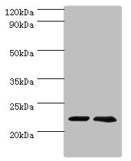 ASF1A Antibody - Western blot All lanes: ASF1A antibody at 2µg/ml Lane 1: Jurkat whole cell lysate Lane 2: A431 whole cell lysate Secondary Goat polyclonal to rabbit IgG at 1/10000 dilution Predicted band size: 23 kDa Observed band size: 23 kDa
