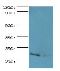 ASF1A Antibody - Western blot. All lanes: ASF1A antibody at 2 ug/ml. Lane 1: Jurkat whole cell lysate. Lane 2: A431 whole cell lysate. Secondary antibody: Goat polyclonal to rabbit at 1:10000 dilution. Predicted band size: 23 kDa. Observed band size: 23 kDa Immunohistochemistry.