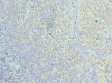 ASF1A Antibody - Immunohistochemistry of paraffin-embedded human tonsil using antibody at 1:100 dilution.