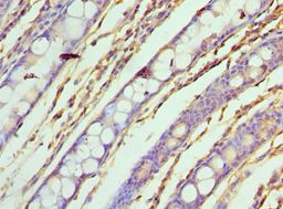 ASF1A Antibody - Immunohistochemistry of paraffin-embedded human rectum using antibody at 1:100 dilution.