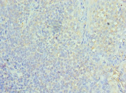 ASF1A Antibody - Immunohistochemistry of paraffin-embedded human tonsil tissue using ASF1A Antibody at dilution of 1:100
