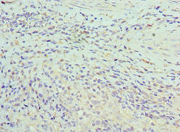 ASF1A Antibody - Immunohistochemistry of paraffin-embedded human epityphlon tissue using ASF1A Antibody at dilution of 1:100