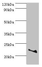 ASF1A Antibody - Western blot All lanes: ASF1A antibody at 2µg/ml + Jurkat whole cell lysate Secondary Goat polyclonal to rabbit IgG at 1/10000 dilution Predicted band size: 23 kDa Observed band size: 23 kDa