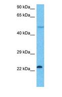 ASF1A Antibody - Western blot of ASF1A Antibody with human Jurkat Whole Cell lysate.  This image was taken for the unconjugated form of this product. Other forms have not been tested.