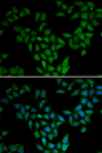 ASF1A Antibody - Immunofluorescence analysis of HeLa cells.