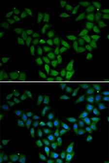 ASF1A Antibody - Immunofluorescence analysis of HeLa cells.