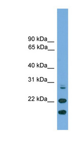 ASF1A Antibody - ASF1A antibody Western blot of THP-1 cell lysate. This image was taken for the unconjugated form of this product. Other forms have not been tested.