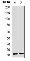 ASF1B Antibody - Western blot analysis of ASF1B expression in Jurkat (A); HeLa (B) whole cell lysates.