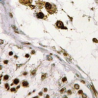 ASF1B Antibody - Immunohistochemical analysis of ASF1B staining in human testis formalin fixed paraffin embedded tissue section. The section was pre-treated using heat mediated antigen retrieval with sodium citrate buffer (pH 6.0). The section was then incubated with the antibody at room temperature and detected with HRP and DAB as chromogen. The section was then counterstained with hematoxylin and mounted with DPX.