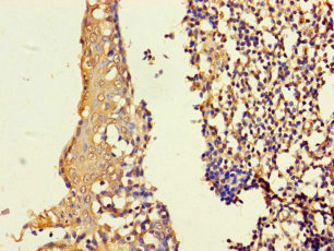 ASF1B Antibody - Immunohistochemistry of paraffin-embedded human tonsil tissue using ASF1B Antibody at dilution of 1:100