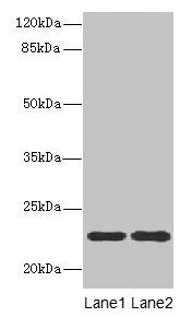 ASF1B Antibody - Western blot All lanes: ASF1B antibody at 13µg/ml Lane 1: Jurkat whole cell lysate Lane 2: Hela whole cell lysate Secondary Goat polyclonal to rabbit IgG at 1/10000 dilution Predicted band size: 22 kDa Observed band size: 22 kDa
