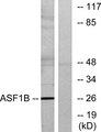 ASF1B Antibody - Western blot analysis of extracts from K562 cells, using ASF1B antibody.