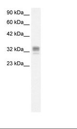 ASGR1 / ASGPR Antibody - Fetal Liver Lysate.  This image was taken for the unconjugated form of this product. Other forms have not been tested.
