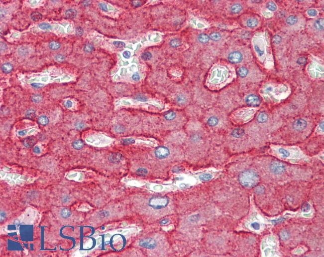 ASGR1 / ASGPR Antibody - Anti-ASGR1 / ASGPR antibody IHC staining of human liver. Immunohistochemistry of formalin-fixed, paraffin-embedded tissue after heat-induced antigen retrieval. Antibody concentration 10 ug/ml.  This image was taken for the unconjugated form of this product. Other forms have not been tested.
