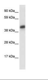 ASGR1 / ASGPR Antibody - Fetal Liver Lysate.  This image was taken for the unconjugated form of this product. Other forms have not been tested.