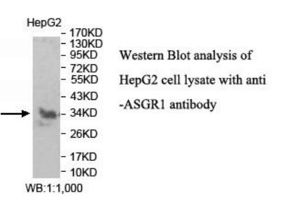 ASGR1 / ASGPR Antibody - Western blot of ASGR1 / ASGPR antibody