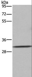 ASGR1 / ASGPR Antibody - Western blot analysis of 231 cell, using ASGR1 Polyclonal Antibody at dilution of 1:300.