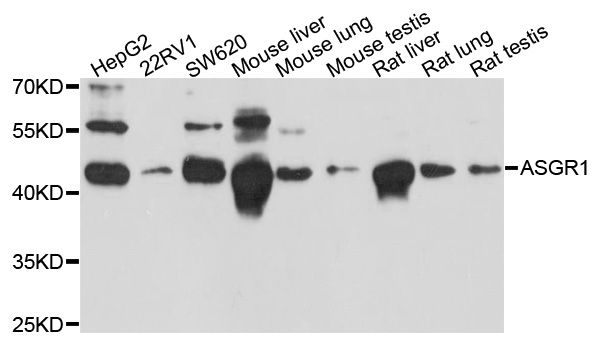 ASGR1 / ASGPR Antibody - Western blot analysis of extracts of various cell lines, using ASGR1 antibody at 1:1000 dilution. The secondary antibody used was an HRP Goat Anti-Rabbit IgG (H+L) at 1:10000 dilution. Lysates were loaded 25ug per lane and 3% nonfat dry milk in TBST was used for blocking. An ECL Kit was used for detection and the exposure time was 30s.