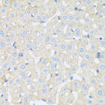 ASGR1 / ASGPR Antibody - Immunohistochemistry of paraffin-embedded Rat liver using ASGR1 Polyclonal Antibody at dilution of 1:100 (40x lens).