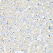 ASGR1 / ASGPR Antibody - Immunohistochemistry of paraffin-embedded Rat liver using ASGR1 Polyclonal Antibody at dilution of 1:100 (40x lens).