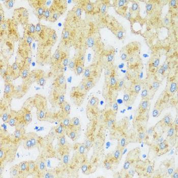 ASGR1 / ASGPR Antibody - Immunohistochemistry of paraffin-embedded Human liver using ASGR1 Polyclonal Antibody at dilution of 1:100 (40x lens).