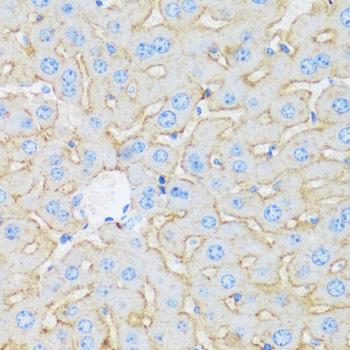 ASGR1 / ASGPR Antibody - Immunohistochemistry of paraffin-embedded Mouse liver using ASGR1 Polyclonal Antibody at dilution of 1:100 (40x lens).