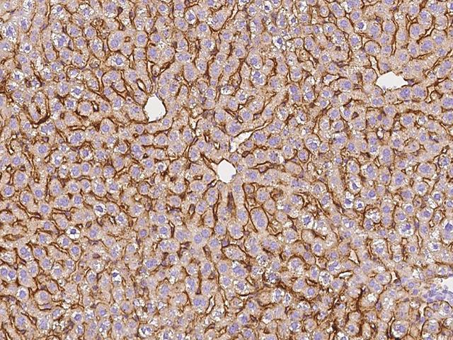 ASGR1 / ASGPR Antibody - Immunochemical staining of mouse ASGR1 in mouse liver with rabbit polyclonal antibody at 1:1000 dilution, formalin-fixed paraffin embedded sections.