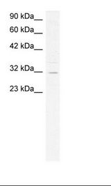 ASGR2 Antibody - HepG2 Cell Lysate.  This image was taken for the unconjugated form of this product. Other forms have not been tested.