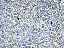 ASGR2 Antibody - ASGR2 antibody ARP33821_T100-NP_001172-ASGR2 (asialoglycoprotein receptor 2) Antibody was used in IHC to stain formalin-fixed, paraffin-embedded human spleen.  This image was taken for the unconjugated form of this product. Other forms have not been tested.