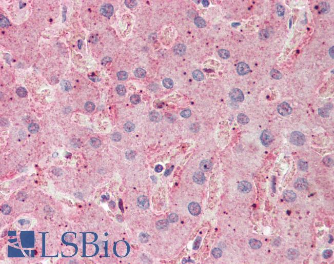 ASGR2 Antibody - Anti-ASGR2 antibody IHC staining of human liver. Immunohistochemistry of formalin-fixed, paraffin-embedded tissue after heat-induced antigen retrieval. Antibody concentration 5 ug/ml.  This image was taken for the unconjugated form of this product. Other forms have not been tested.