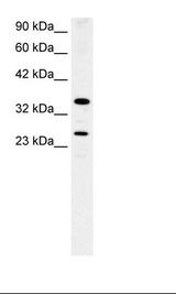 ASGR2 Antibody - Fetal Lung Lysate.  This image was taken for the unconjugated form of this product. Other forms have not been tested.