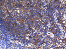ASGR2 Antibody - IHC of paraffin-embedded Human lymph node tissue using anti-ASGR2 mouse monoclonal antibody.