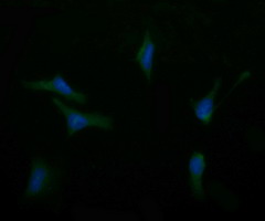 ASGR2 Antibody - Immunofluorescent staining of HeLa cells using anti-ASGR2 mouse monoclonal antibody.