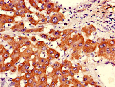 ASGR2 Antibody - Immunohistochemistry of paraffin-embedded human liver tissue using ASGR2 Antibody at dilution of 1:100