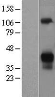 ASGR2 Protein - Western validation with an anti-DDK antibody * L: Control HEK293 lysate R: Over-expression lysate
