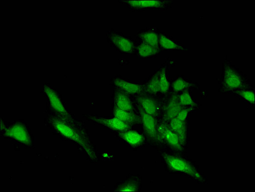 ASH1L / ASH1 Antibody - Immunofluorescent analysis of Hela cells using ASH1L Antibody at a dilution of 1:100 and Alexa Fluor 488-congugated AffiniPure Goat Anti-Rabbit IgG(H+L)