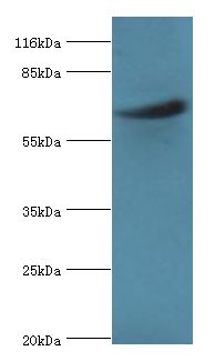 ASH2L / ASH2 Antibody - Western blot. All lanes: Set1/Ash2 histone methyltransferase complex subunit ASH2 antibody at 2 ug/ml+K562 whole cell lysate. Secondary antibody: Goat polyclonal to rabbit at 1:10000 dilution. Predicted band size: 69 kDa. Observed band size: 69 kDa.  This image was taken for the unconjugated form of this product. Other forms have not been tested.