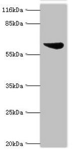 ASH2L / ASH2 Antibody - Western blot All lanes: Set1/Ash2 histone methyltransferase complex subunit ASH2 antibody at 2µg/ml + K562 whole cell lysate Secondary Goat polyclonal to rabbit IgG at 1/10000 dilution Predicted band size: 69, 57, 61 kDa Observed band size: 69 kDa