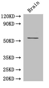 ASH2L / ASH2 Antibody - Western Blot Positive WB detected in: Mouse brain tissue All lanes: ASH2L antibody at 3µg/ml Secondary Goat polyclonal to rabbit IgG at 1/50000 dilution Predicted band size: 69, 57, 61 kDa Observed band size: 69 kDa