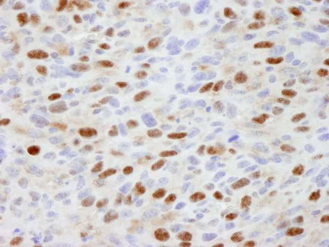 ASH2L / ASH2 Antibody - Detection of Mouse ASH2 by Immunohistochemistry. Sample: FFPE section of mouse squamous cell carcinoma. Antibody: Affinity purified rabbit anti-ASH2 used at a dilution of 1:1000 (1 ug/ml).