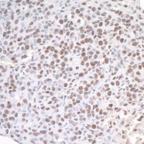 ASH2L / ASH2 Antibody - Detection of mouse ASH2 by immunohistochemistry. Sample: FFPE section of mouse CT26 colon carcinoma. Antibody: Affinity purified rabbit anti-ASH2 used at a dilution of 1:1,000 (1µg/ml). Detection: DAB